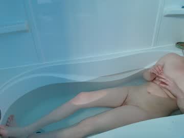 skyewatson